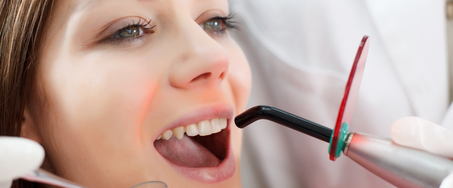 The Benefits of Laser Dental Cleaning