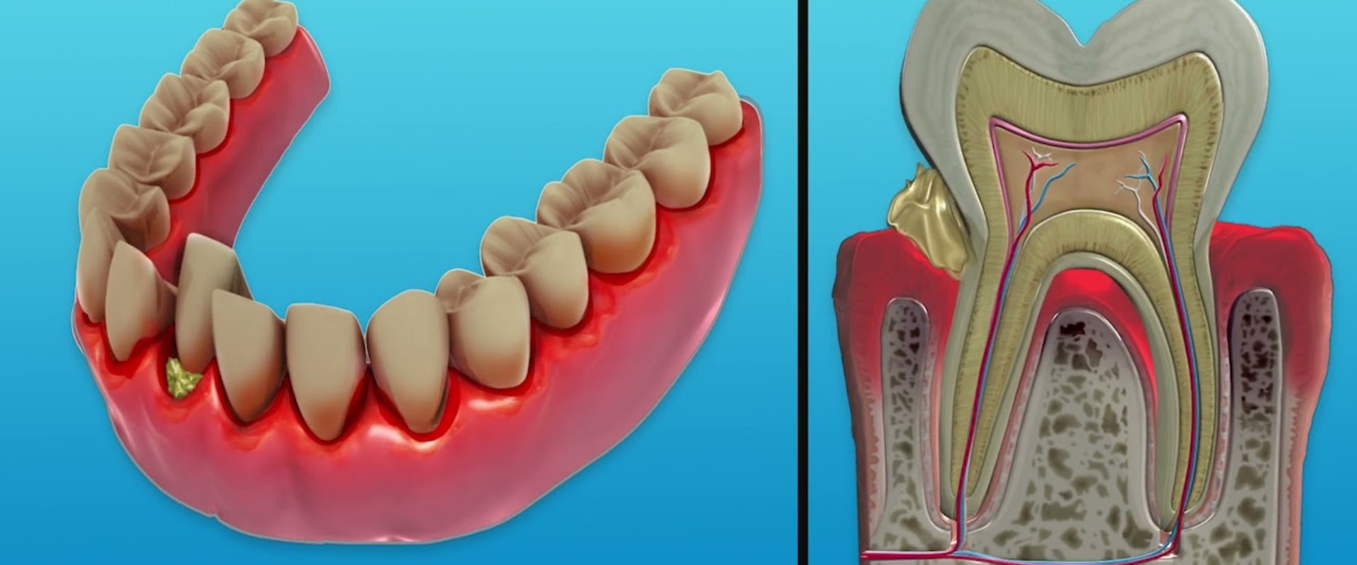 why-dental-laser-cleaning-is-the-most-efficient-way-to-clean-your-teeth