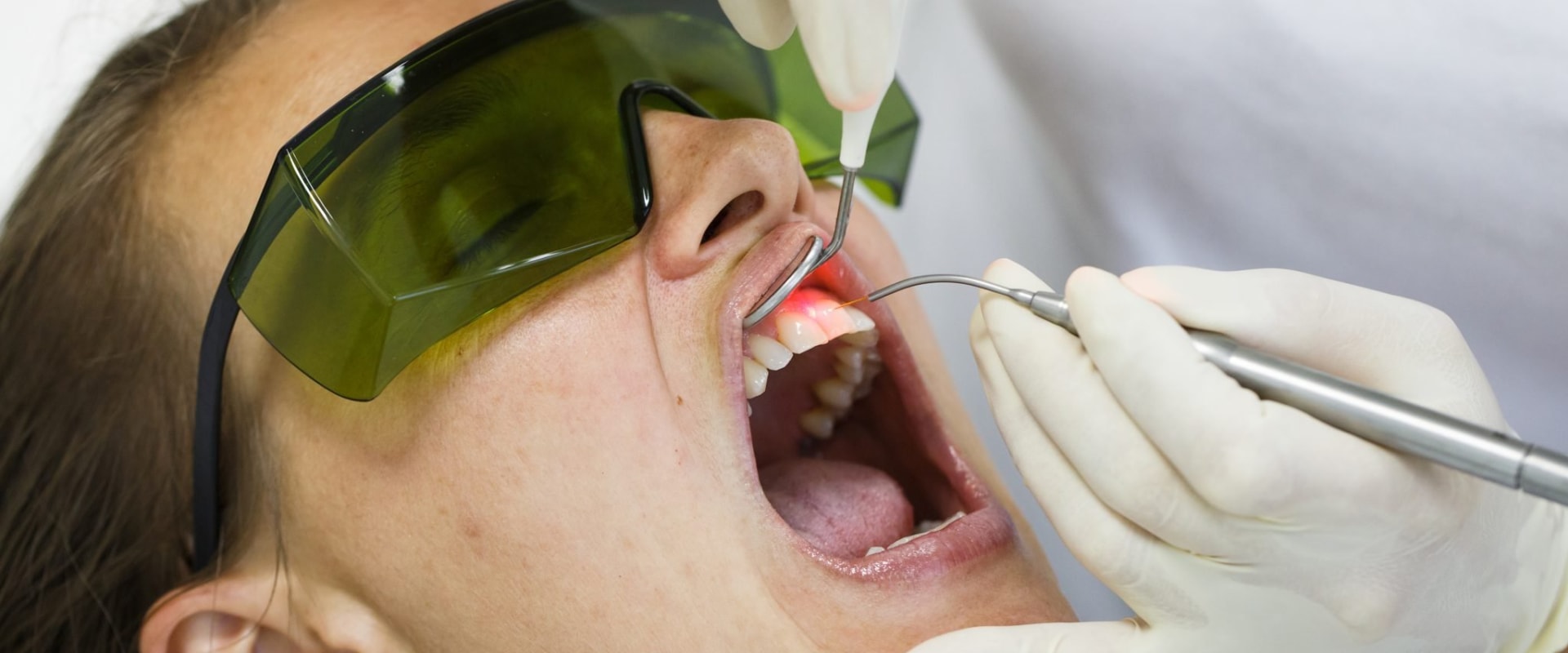 Is Laser Teeth Cleaning Painless?