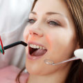 The Benefits of Laser Dental Cleaning