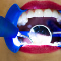 Why You Should Choose Dental Laser Cleaning For Your Next Appointment In Cedar Park