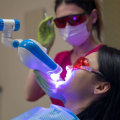 Experience The Benefits Of Dental Laser Cleaning From A Top Dentist In Waco, Texas