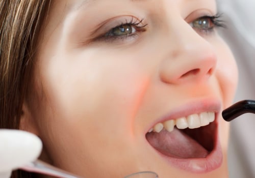 The Benefits of Laser Teeth Cleaning