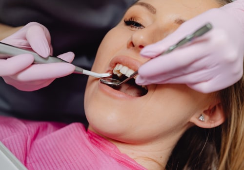 Sydney's Smile Secret: How Dental Laser Cleaning Transforms Holistic Tooth Care