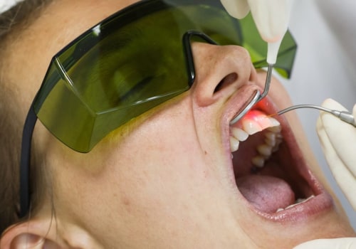 The Benefits and Risks of Laser Dentistry