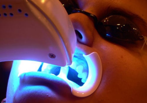 The Advantages Of Dental Laser Cleaning For Teeth Whitening In Austin